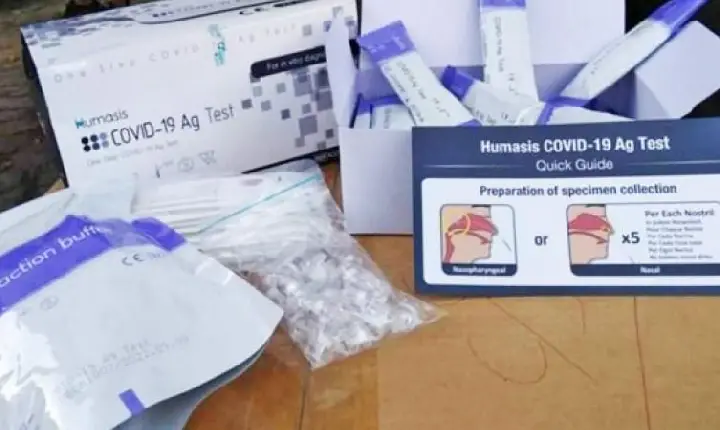 Procon notifica laboratórios e farmácias por preços abusivos de testes de Covid-19