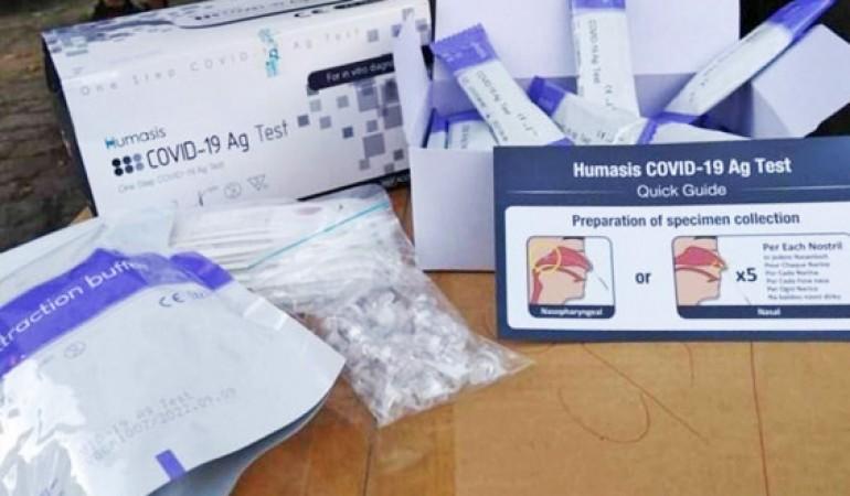 Procon notifica laboratórios e farmácias por preços abusivos de testes de Covid-19