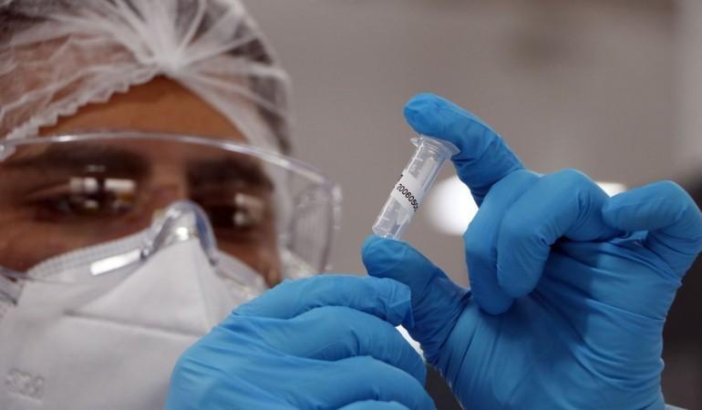 TO registra 1.803 novos casos, duas mortes por Covid-19 e chega a 211 internações
